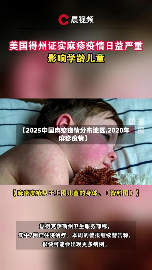 【2025中国麻疹疫情分布地区,2020年麻疹疫情】-第3张图片